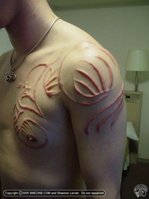 Scarification